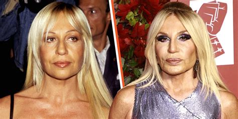 Experts Believe Donatella Versace Had Several Plastic Surgeries 